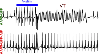 CPVT gene therapy figure