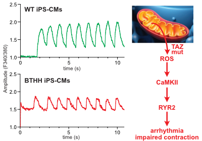 CaMKII activation in Barth syndrome figure