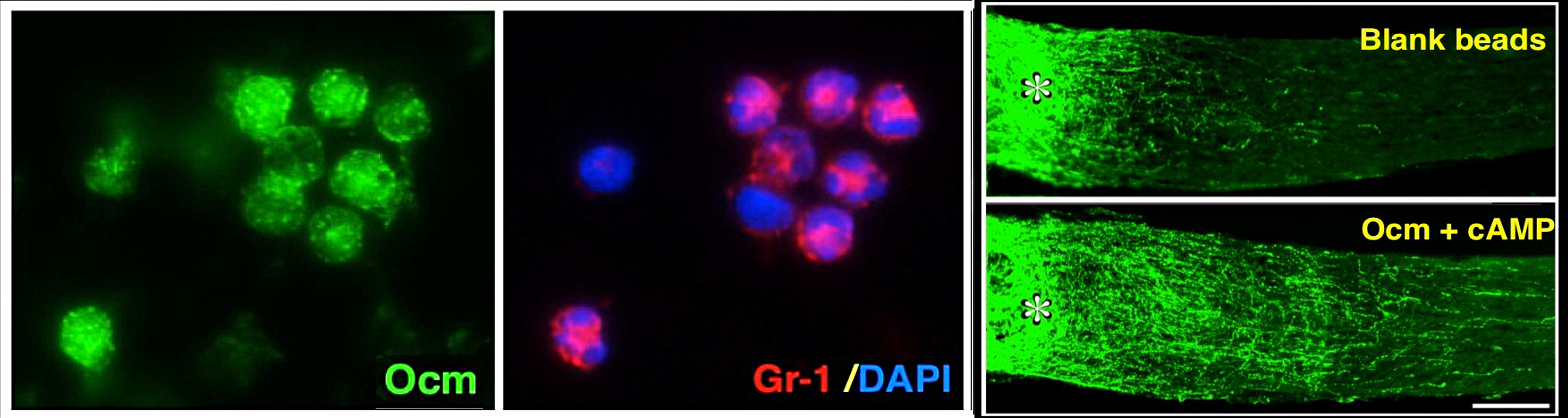 Four panels showing the microscopic process of inflammation and regeneration.