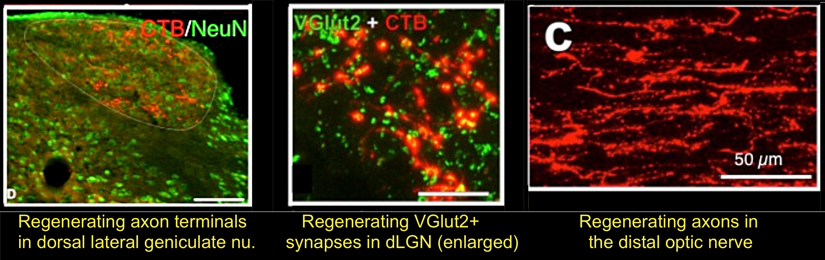 Long distance regeneration.