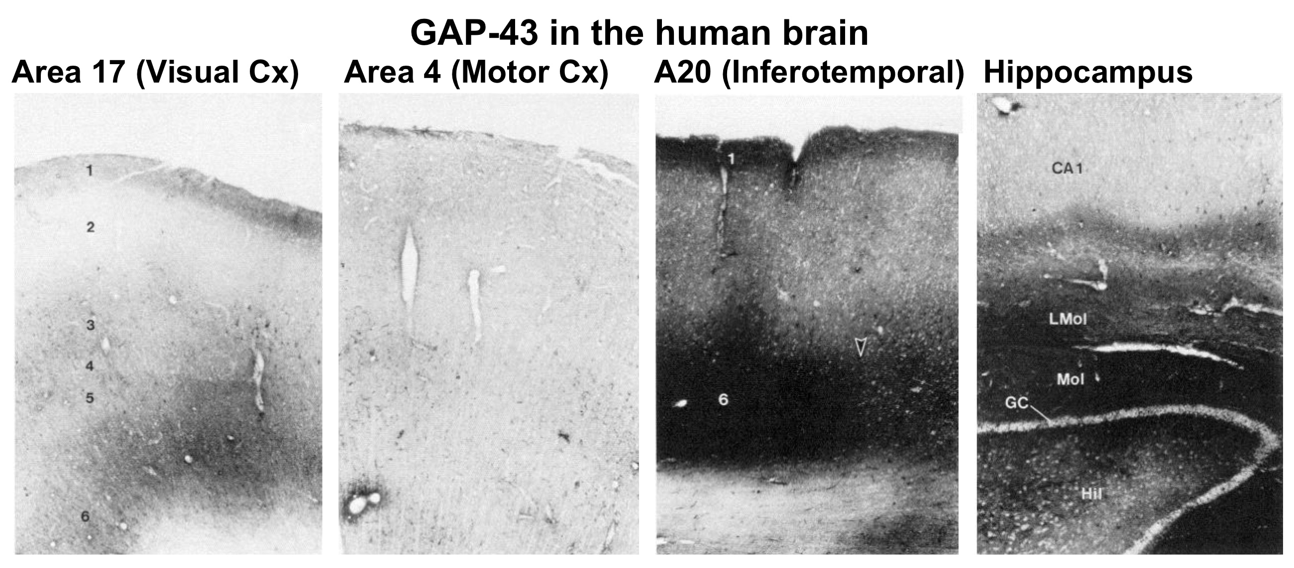 GAP 43 human, black and white microscopic image of brain cells.