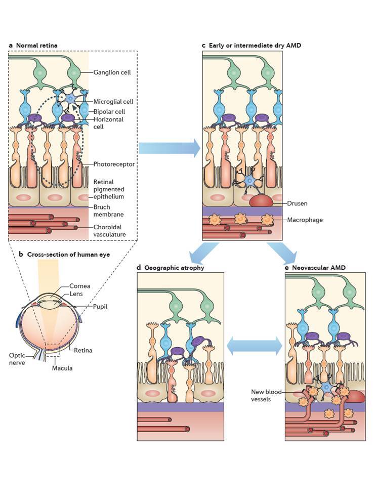 Diagram of AMD